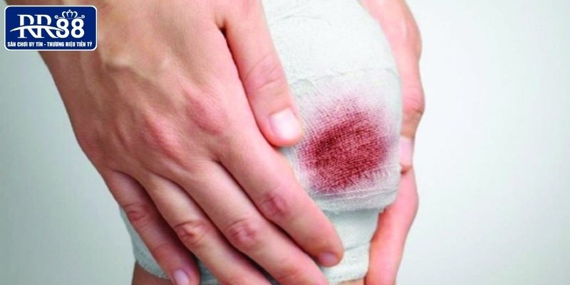 Mơ chân bị chảy máu là lời nhắc nhở