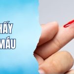 mơ thấy chảy máu rr88