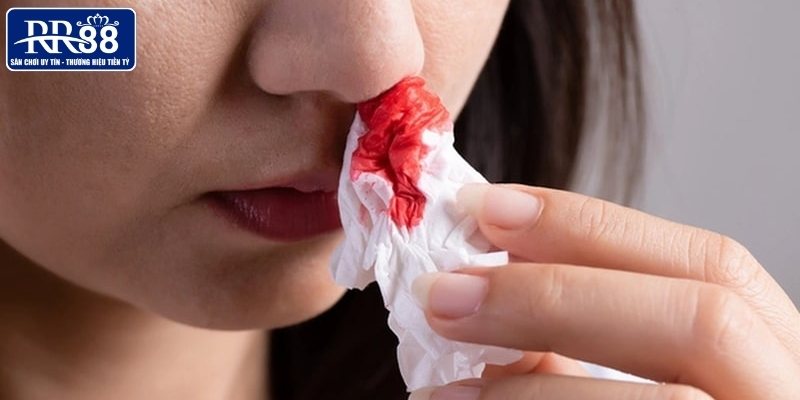 Trường hợp mơ thấy chảy máu cam 